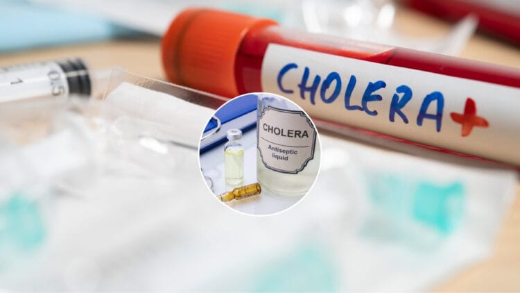 Pierwszy przypadek cholery w Polsce od lat - sprawdź czy grozi nam większe zagrożenie