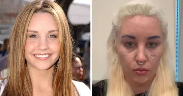 Amanda Bynes: szokująca metamorfoza gwiazdy dziecięcych hitów