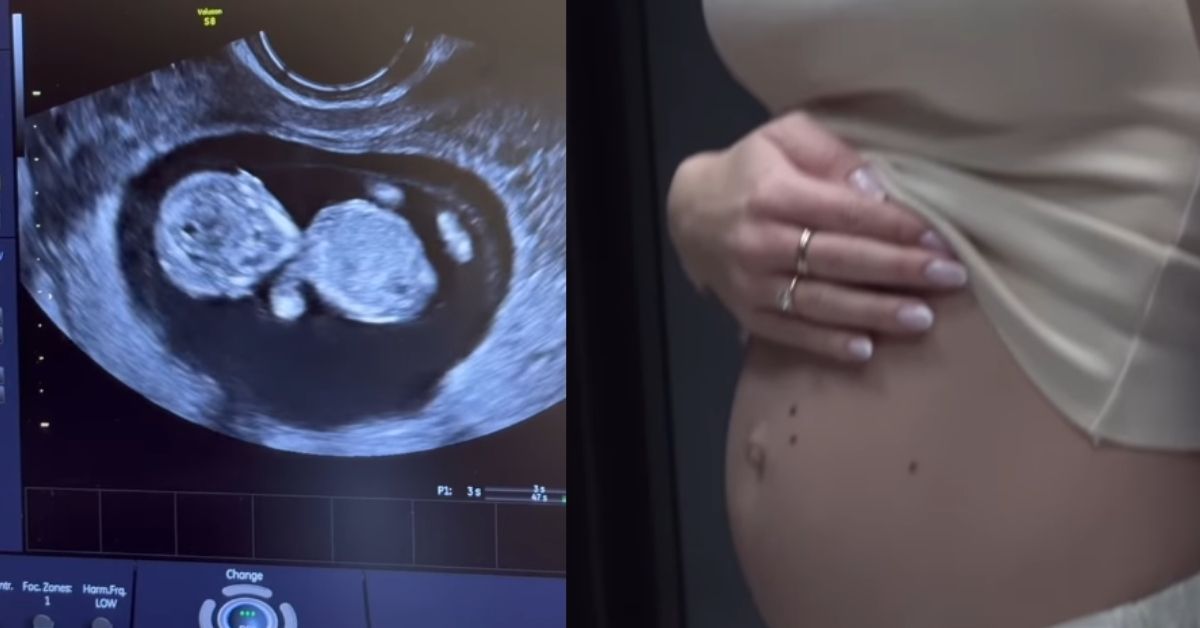 Friz i Wersow ciąża